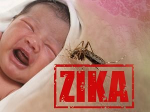 Read more about the article Zika affects the eyes of the toddlers