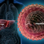 Pakistan set to eradicate Hepatitis by 2030