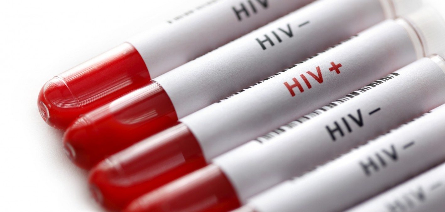 Read more about the article Awareness can contain HIV