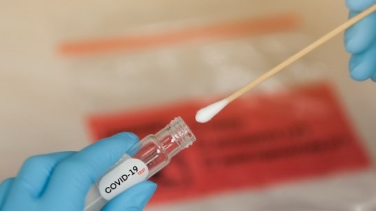 Read more about the article Harvard researchers want more ‘crappy’ tests for COVID-19