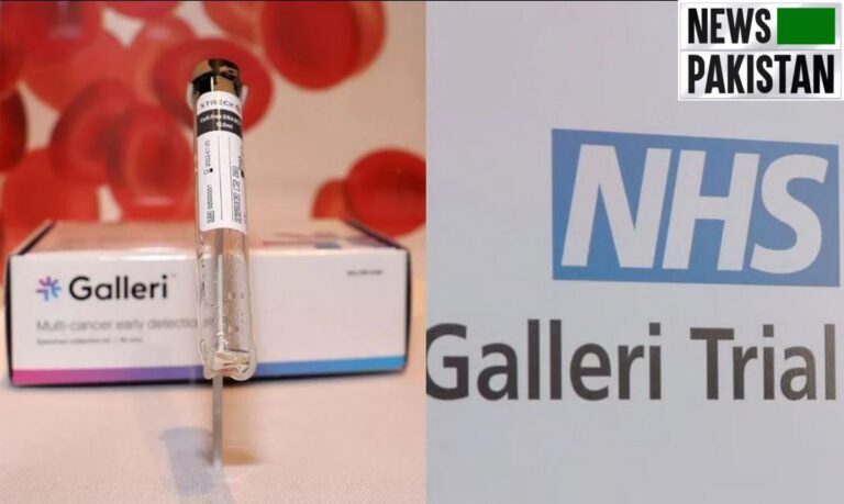 Cancer: Galleri test speeds up diagnosis